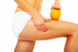 Celulitis – Preparación Gel Reductivo